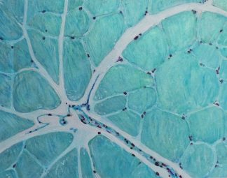 (Skeletal) Muscle in Blue #1 by Sarah Schneeman.